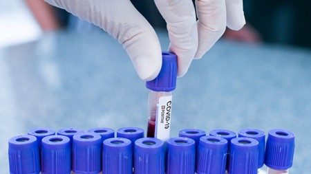 Задержка выдачи результатов анализов, в связи резким увеличением спроса на тестирования на антитела к COVID-19 Задержка выдачи результатов анализов, в связи резким увеличением спроса на тестирования на антитела к COVID-19